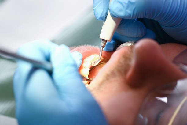 Best Weekend Emergency Dental Services in Maugansville, MD
