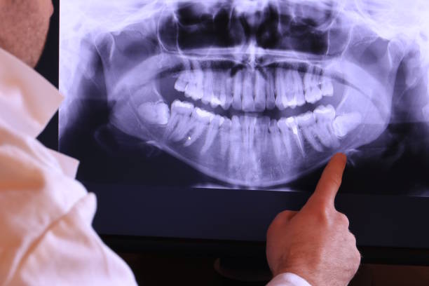 Best Urgent Dental Care for Toothaches in Maugansville, MD