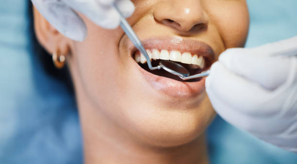 Best Emergency Wisdom Tooth Extraction in Maugansville, MD